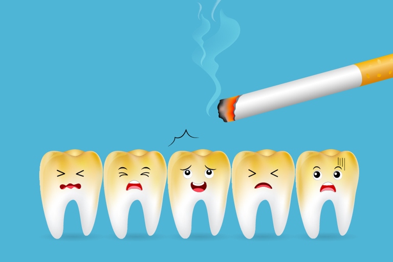 Yes, a dentist can tell if you vape or smoke cigarettes by looking at the health of your teeth and gums.
